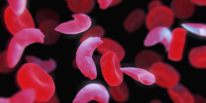 Sickle-cell Disease